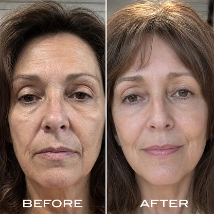 Renewal Serum Routine