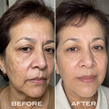 Renewal Serum Routine