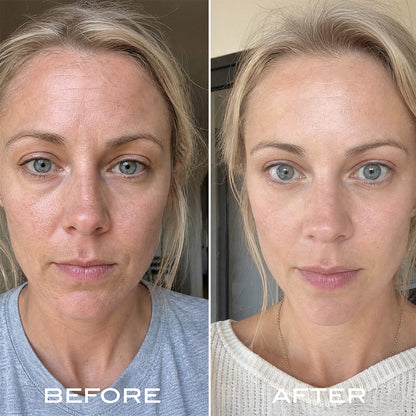Renewal Serum Routine