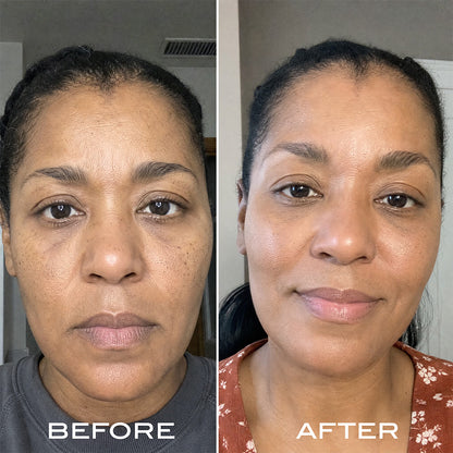 Renewal Serum Routine