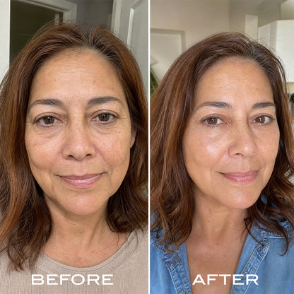 Renewal Serum Routine